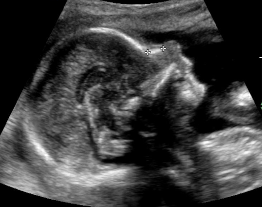 Where are the best introductory level OB/GYN Ultrasound Courses?